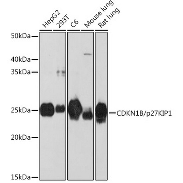 CDKN1B/p27KIP1 Rabbit mAb (A19095)