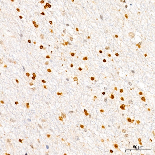 A19095: CDKN1B/p27KIP1 Rabbit mAb