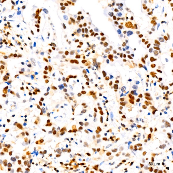 CDKN1B/p27KIP1 Rabbit mAb (Catalog Number: A19095) Abclonal