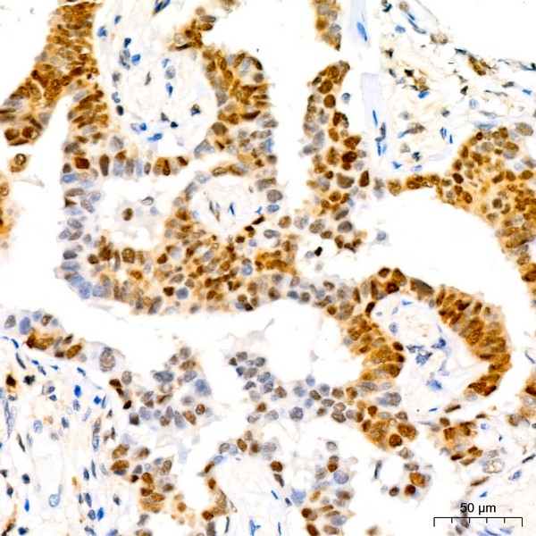 Abclonal CDKN1B/p27KIP1 Rabbit mAb (Catalog Number: A19095)