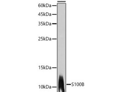 S100B Rabbit mAb (A19108)