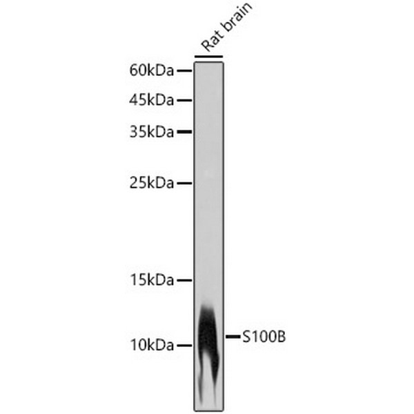 S100B Rabbit mAb (A19108) S100B Rabbit mAb (A19108)
