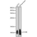 A19108: S100B Rabbit mAb