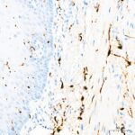 S100B Rabbit mAb (Catalog Number: A19108) Abclonal