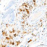 Abclonal S100B Rabbit mAb (Catalog Number: A19108)
