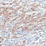 Abclonal [KO Validated] Smad4 Rabbit mAb (A19116)