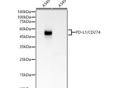 PD-L1/CD274 Rabbit mAb (A19135)