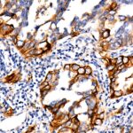 A19135: PD-L1/CD274 Rabbit mAb