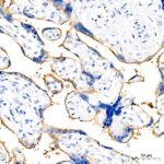 PD-L1/CD274 Rabbit mAb (Catalog Number: A19135) Abclonal