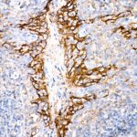 Abclonal PD-L1/CD274 Rabbit mAb (Catalog Number: A19135)