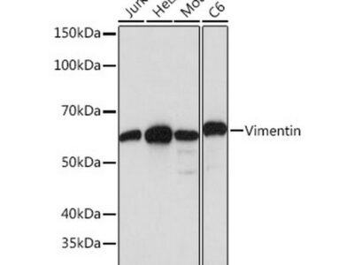 [KO Validated] Vimentin Rabbit mAb (A19607)