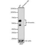 A19607: [KO Validated] Vimentin Rabbit mAb