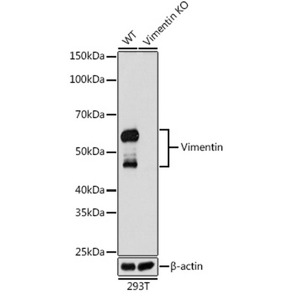 A19607: [KO Validated] Vimentin Rabbit mAb