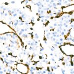 Abclonal [KO Validated] Vimentin Rabbit mAb (Catalog Number: A19607)