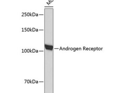Androgen Receptor Rabbit mAb (A19611)