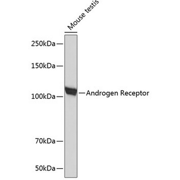 Androgen Receptor Rabbit mAb (A19611) Androgen Receptor Rabbit mAb (A19611)