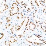 A19611: Androgen Receptor Rabbit mAb
