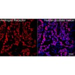 Androgen Receptor Rabbit mAb (Catalog Number: A19611) Abclonal
