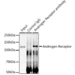 Abclonal Androgen Receptor Rabbit mAb (Catalog Number: A19611)