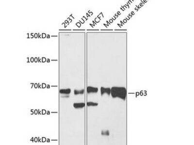 p63 Rabbit mAb (A19652)