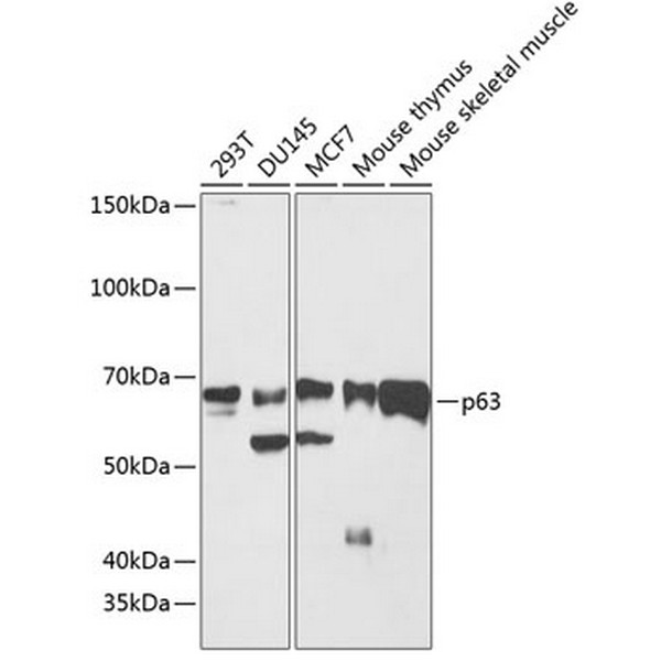 p63 Rabbit mAb (A19652) p63 Rabbit mAb (A19652)
