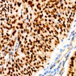 A19652: p63 Rabbit mAb