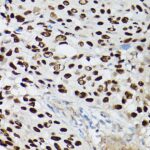 p63 Rabbit mAb (Catalog Number: A19652) Abclonal