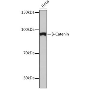 [KO Validated] β-Catenin Rabbit mAb (A19657)