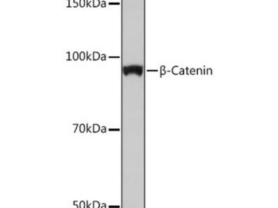 [KO Validated] β-Catenin Rabbit mAb (A19657)
