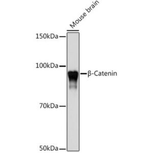 A19657: [KO Validated] β-Catenin Rabbit mAb