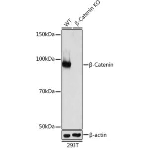 [KO Validated] β-Catenin Rabbit mAb (Catalog Number: A19657)
