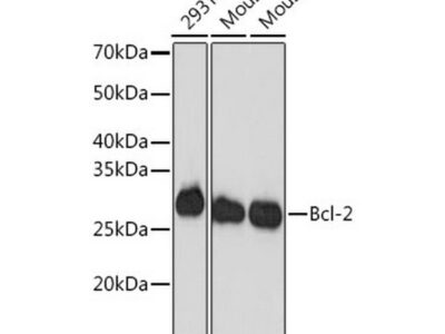 Bcl-2 Rabbit mAb (A19693)