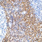 A19693: Bcl-2 Rabbit mAb