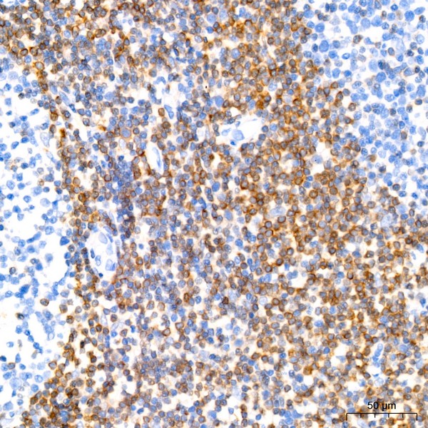 A19693: Bcl-2 Rabbit mAb