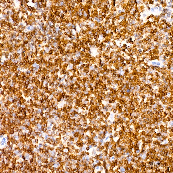 Bcl-2 Rabbit mAb (Catalog Number: A19693) Abclonal