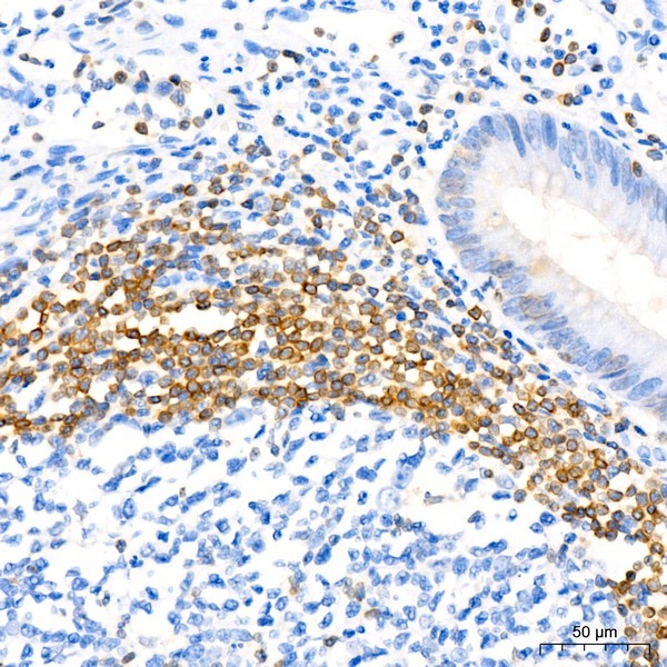 Abclonal Bcl-2 Rabbit mAb (Catalog Number: A19693)