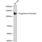 Progesterone Receptor Rabbit mAb (A19697)