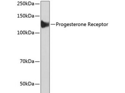 Progesterone Receptor Rabbit mAb (A19697)