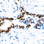 A19697: Progesterone Receptor Rabbit mAb