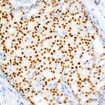 Progesterone Receptor Rabbit mAb (Catalog Number: A19697) Abclonal