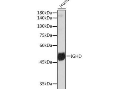 IGHD Rabbit mAb (A19708)