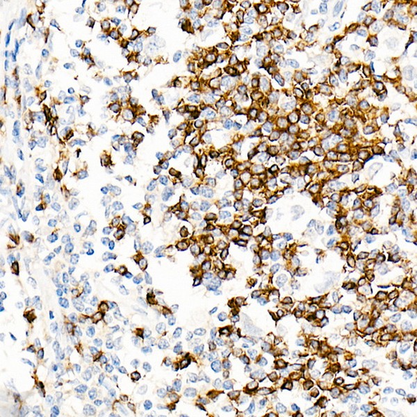 IGHD Rabbit mAb (Catalog Number: A19708) Abclonal