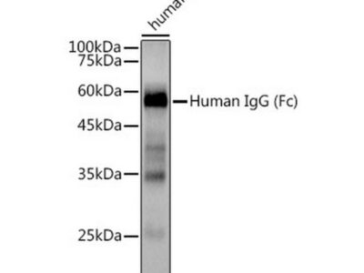 Human IgG Rabbit mAb (A19711)