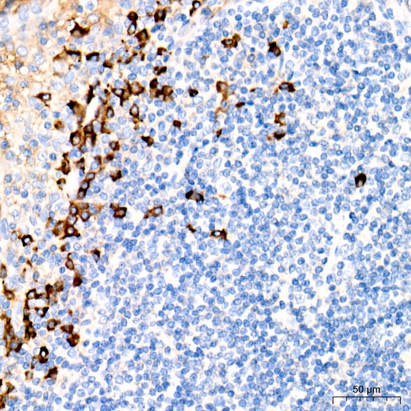 A19711: Human IgG Rabbit mAb