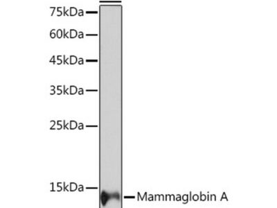 Mammaglobin A Rabbit mAb (A19727)