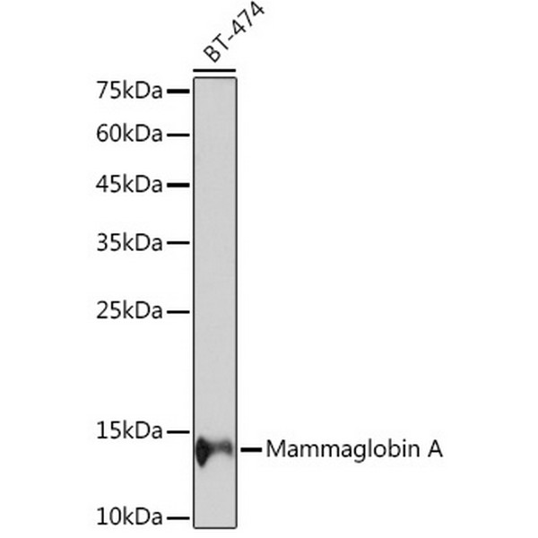 A19727-1 Mammaglobin A Rabbit mAb (A19727)
