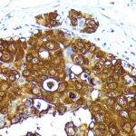 A19727: Mammaglobin A Rabbit mAb