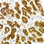 Mammaglobin A Rabbit mAb (Catalog Number: A19727) Abclonal