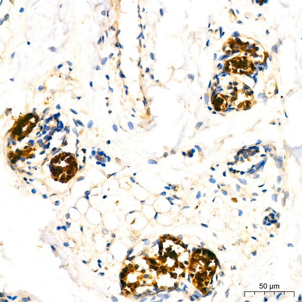 Abclonal Mammaglobin A Rabbit mAb (Catalog Number: A19727)