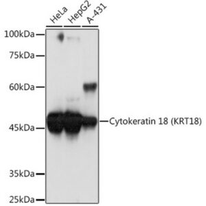 Cytokeratin 18 (KRT18) Rabbit mAb (A19778)